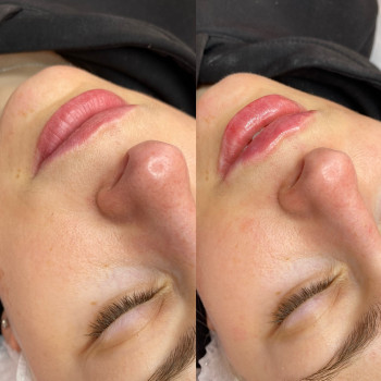 ?, фото - косметолог-инъекционист Олена Поліщук