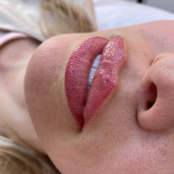 ?, фото - косметолог-инъекционист Олена Поліщук