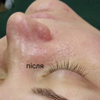 Алла Дерев'янко, Кременчук Фото - 7