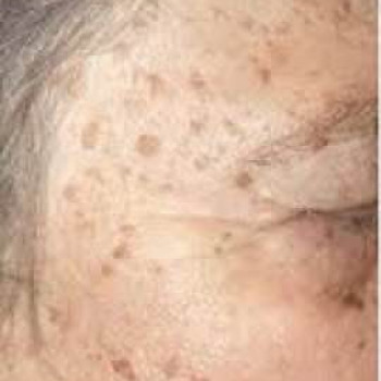 DEKA SYNCHRO FT
                    Студия татуажа Школа-студия Татьяны Поливановой Одесса