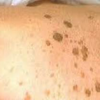 DEKA SYNCHRO FT
                    Студия татуажа Школа-студия Татьяны Поливановой Одесса