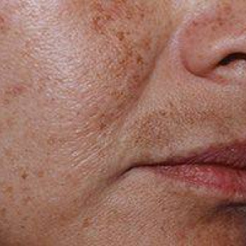 DEKA SYNCHRO FT
                    Студия татуажа Школа-студия Татьяны Поливановой Одесса