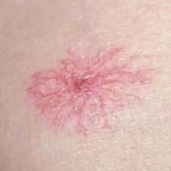 DEKA SYNCHRO FT
                    Студия татуажа Школа-студия Татьяны Поливановой Одесса