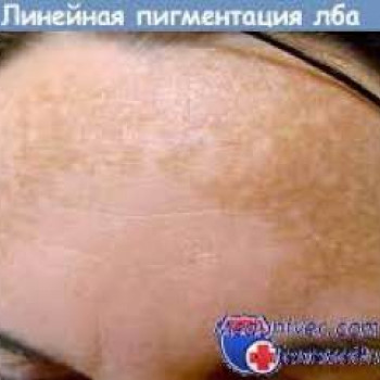 DEKA SYNCHRO FT
                    Студия татуажа Школа-студия Татьяны Поливановой Одесса