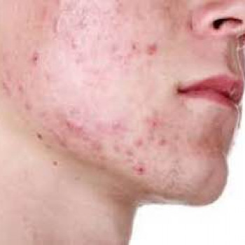 DEKA SYNCHRO FT
                    Студия татуажа Школа-студия Татьяны Поливановой Одесса