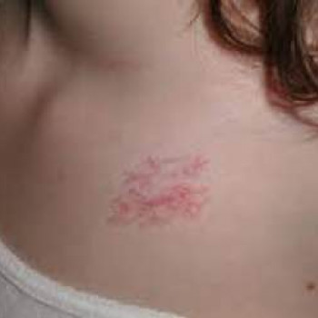 DEKA SYNCHRO FT
                    Студия татуажа Школа-студия Татьяны Поливановой Одесса