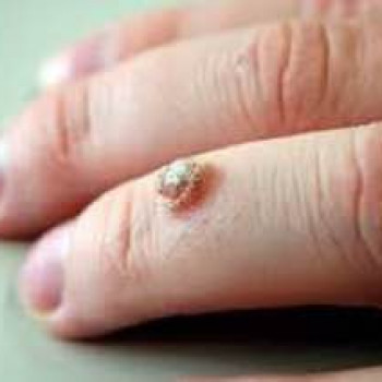 DEKA SYNCHRO FT
                    Студия татуажа Школа-студия Татьяны Поливановой Одесса