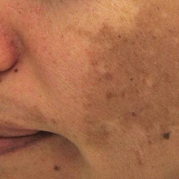 DEKA SYNCHRO FT
                    Студия татуажа Школа-студия Татьяны Поливановой Одесса