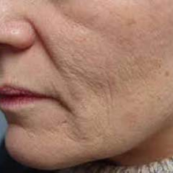 DEKA SYNCHRO FT
                    Студия татуажа Школа-студия Татьяны Поливановой Одесса