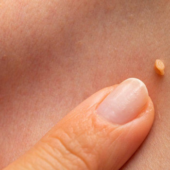 DEKA SYNCHRO FT
                    Студия татуажа Школа-студия Татьяны Поливановой Одесса