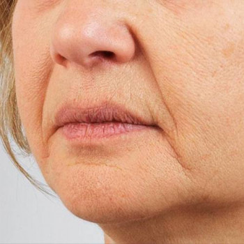 DEKA SYNCHRO FT
                    Студия татуажа Школа-студия Татьяны Поливановой Одесса