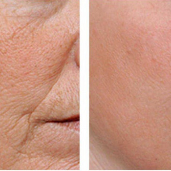 DEKA SYNCHRO FT
                    Студия татуажа Школа-студия Татьяны Поливановой Одесса