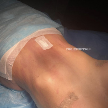 Абдель Эрритали, Київ Фото - 53