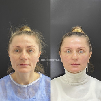 Абдель Эрритали, Київ Фото - 54