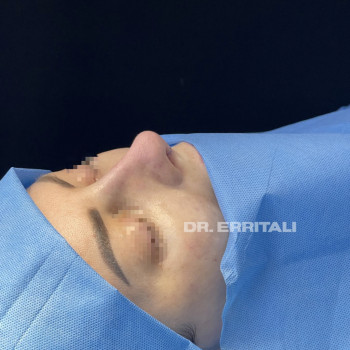 Абдель Эрритали, Київ Фото - 55