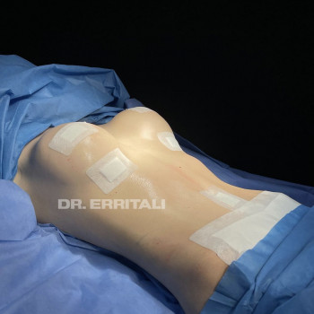 Абдель Эрритали, Київ Фото - 38