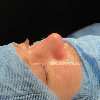 Абдель Эрритали, Київ Фото - 58