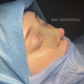 Абдель Эрритали, Київ Фото - 61