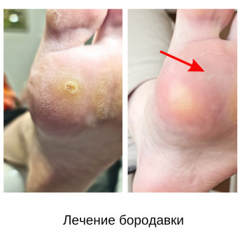 Руслана Петровна Гончарова, Одесса Фото - 71