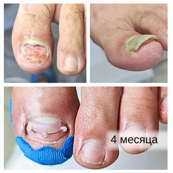 Руслана Петровна Гончарова, Одесса Фото - 79