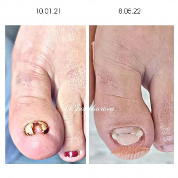 Руслана Петровна Гончарова, Одесса Фото - 85