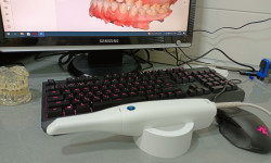 3D сканирование Ортодонт Юрій Вікторович Николаев