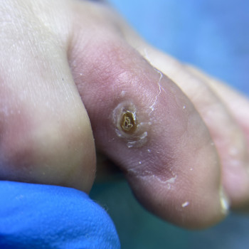 Тетяна Токар, Рівне Фото - 14