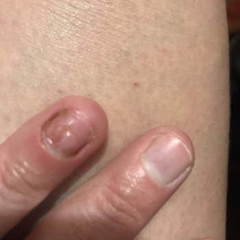 Тетяна Токар, Рівне Фото - 9