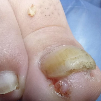 Тетяна Токар, Рівне Фото - 8