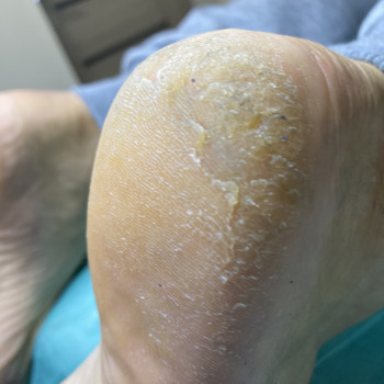 Тетяна Токар, Рівне Фото - 6