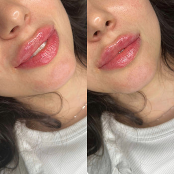 Юлія Кондратюк, Ровно Фото - 26