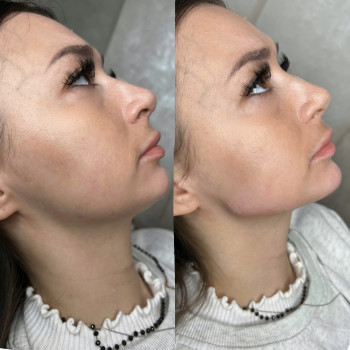 Юлія Кондратюк, Ровно Фото - 27