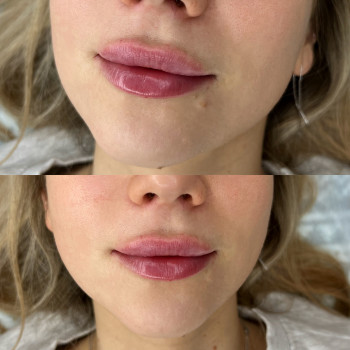 Юлія Кондратюк, Ровно Фото - 29