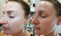 Буккальний масаж обличчя Салон краси Body and face sculpture Київ