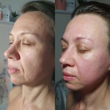 Буккальний масаж обличчя
                    Салон красоты Body and face sculpture Киев