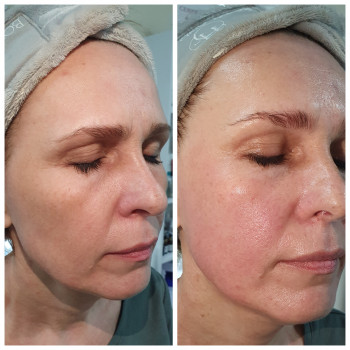 Скульптурний масаж обличчя
                    Салон краси Body and face sculpture Київ