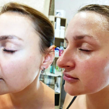 Скульптурний масаж обличчя
                    Салон краси Body and face sculpture Київ