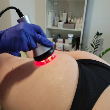 Рф ліфтінг тіла
                    Салон красоты Body and face sculpture Киев