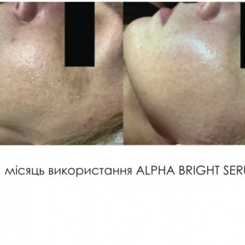 Фото з портфоліо косметолога Ангеліна Золотар (Харків)