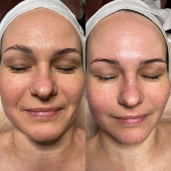 Фото з портфоліо косметолога Ангеліна Золотар (Харків)