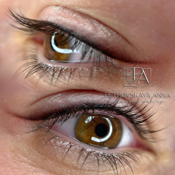 Анна Петровська, Буча Фото - 39