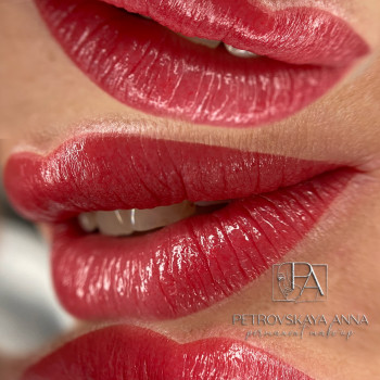 Анна Петровська, Буча Фото - 40