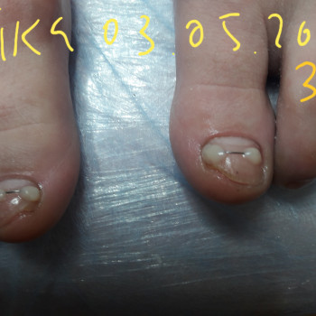 Анжела Кротенко, Кропивницький Фото - 49