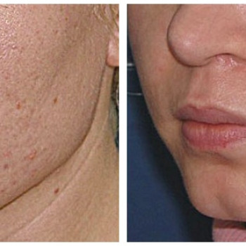 Анастасия Прийтенко, Днепр Фото - 9