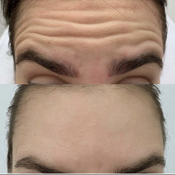 Наталья Деуля, Чернівці Фото - 5