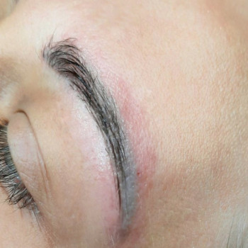 Видалення татуажу ремувером