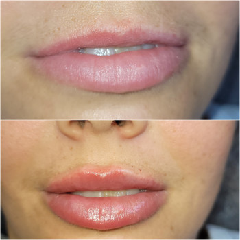 Тетяна Манастирна, Ірпінь Фото - 17