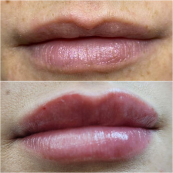 Тетяна Манастирна, Ірпінь Фото - 16