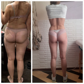 Программа похудения "Стройность и красота!"
                    Косметологічний центр Майстерня краси та здоров'я Slim Дніпро