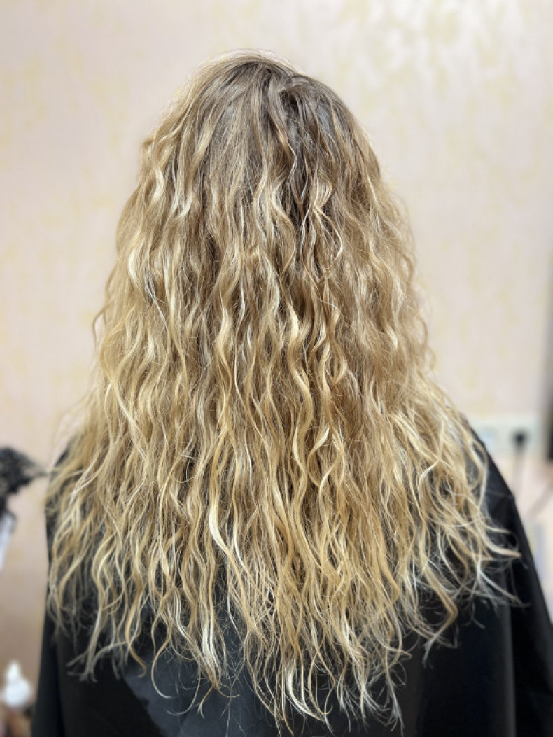 Дівчина думала, що в неї вже немає кудрів, однак процедура д, фото - Тритментолог Дарья Яценко